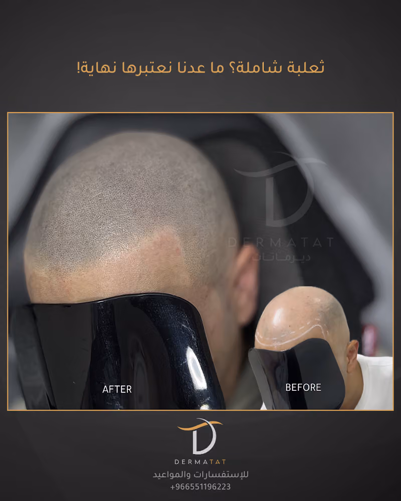 DermaTat Clinic | عيادات ديرماتات