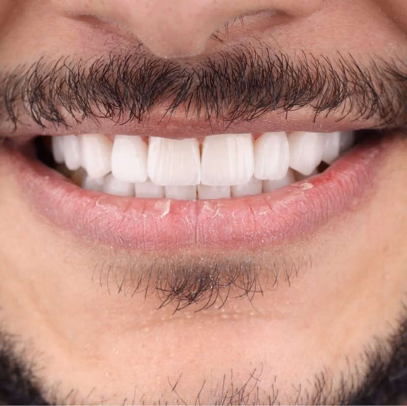 دكتور احمد الصباغ Dr ahmed alsabagh استشاري جراحة الوجه والفكين و زراعة الاسنان