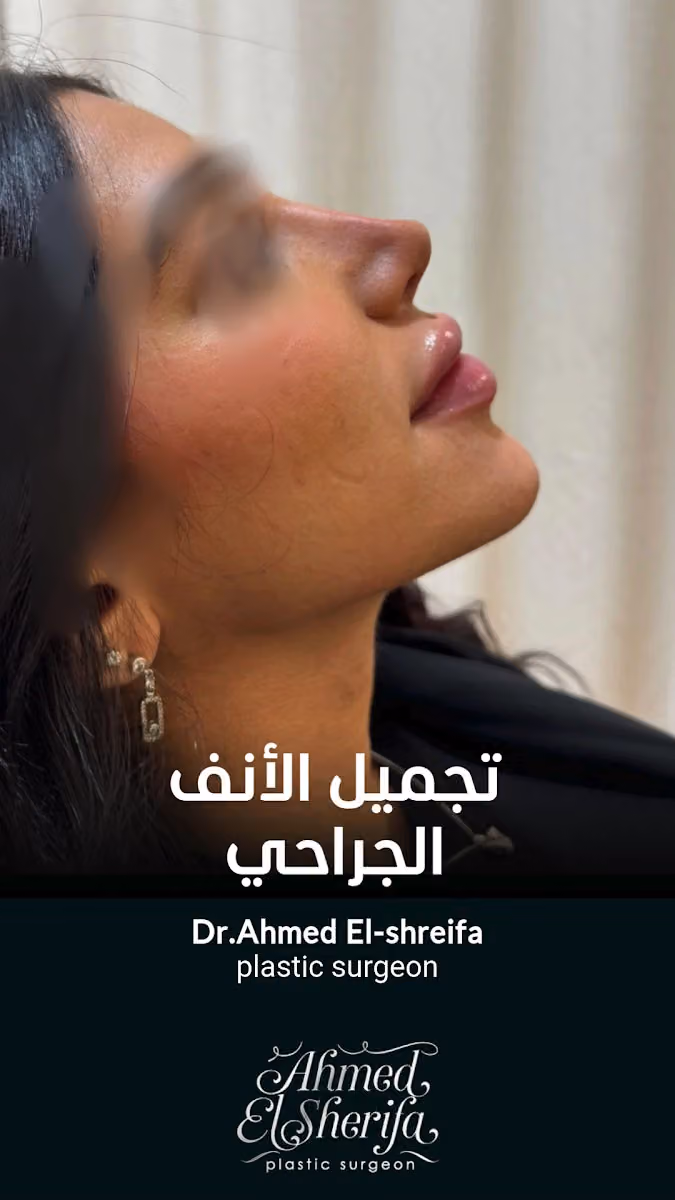 دكتور احمد الشريفة استشاري جراحات التجميل