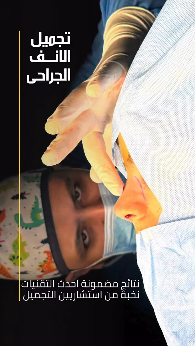 دكتور احمد الشريفة استشاري جراحات التجميل
