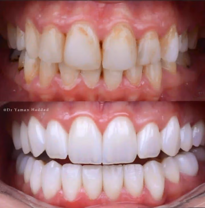 دكتور فراس اسماعيل Dentist feras esmael