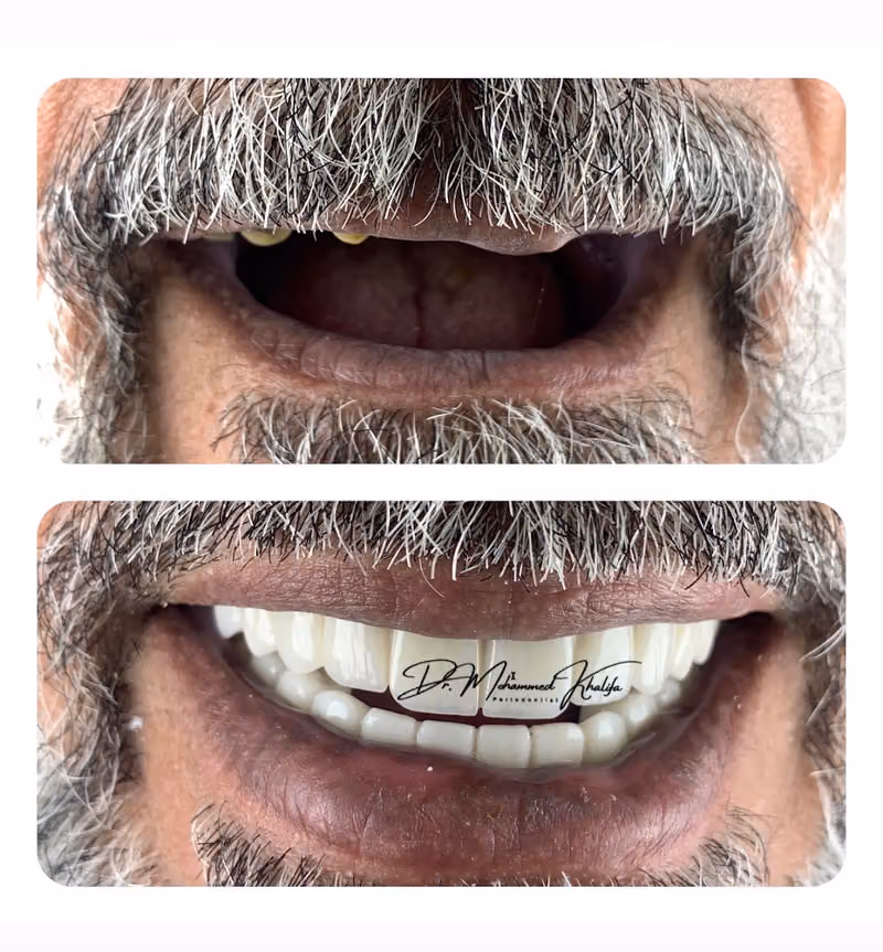 دكتور محمد خليفة اخصائى جراحة. اللثة والزراعة