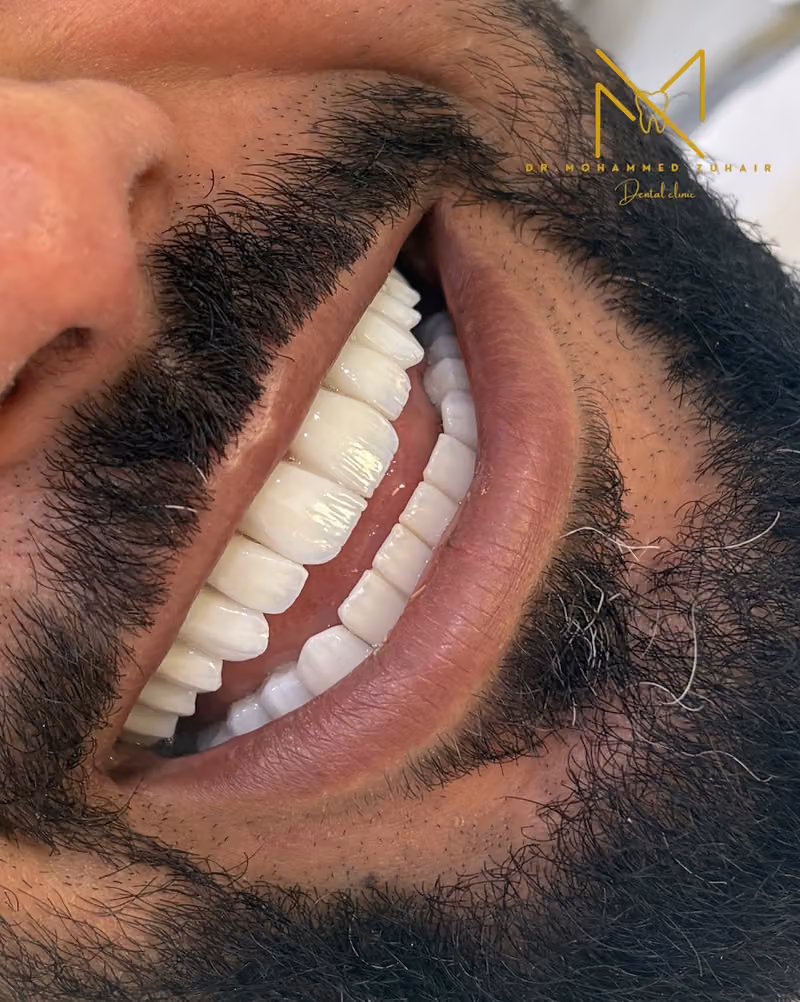 دكتور محمد زهير لطب وتجميل الاسنان { مركز واحة الابتسامة }
