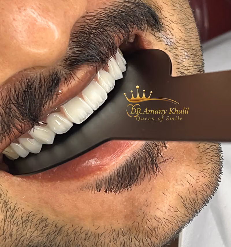 دكتورة اماني خليل لطب وتجميل الاسنان (عيادات بيرل الندوة)