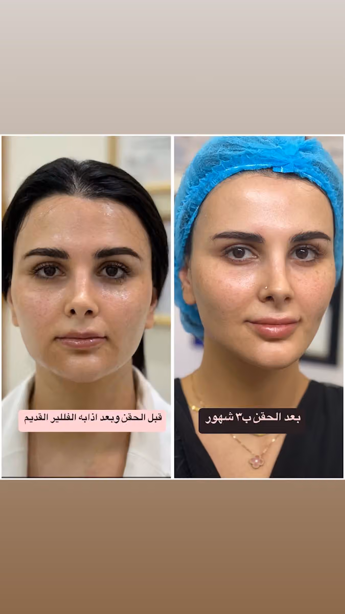 دكتوره مروة حسين - عيادة جلدية وتجميل وعلاج بالليزر