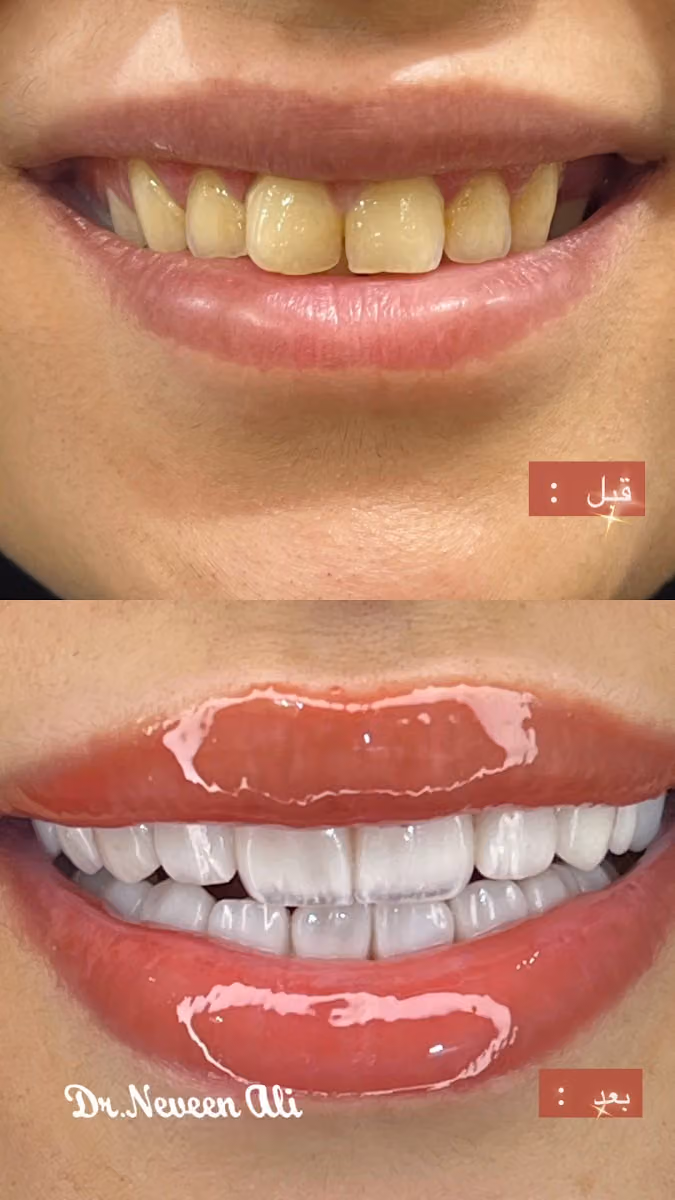 دكتورة نيفين علي لطب وتجميل الأسنان عيادات بيرل الندوة
