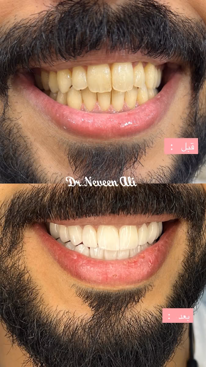 دكتورة نيفين علي لطب وتجميل الأسنان عيادات بيرل الندوة
