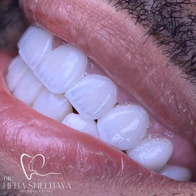 Dr Heba Shelbaya’s Dental Clinic عيادة الدكتورة هبة شلباية لطب الاسنان