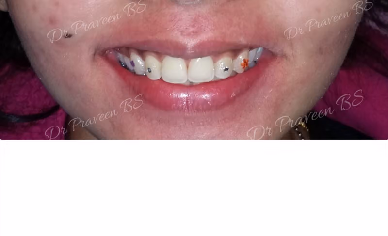 Dr Praveen BS (Consultant Orthodontist, Senior registrar) Riyadh دكتور برافين (اخصائي اول تقويم الاسنان) بالرياض