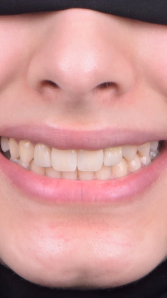 Dr. Ahmad Hamdan Orthodontics