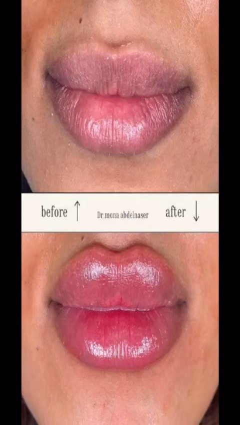 Dr. Mona abdalnaser clinic عيادة دكتوره منى عبد الناصر