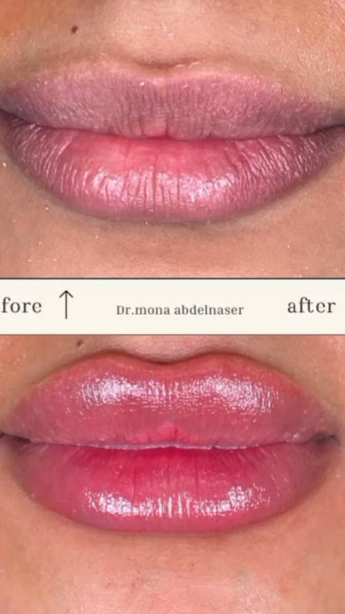 Dr. Mona abdalnaser clinic عيادة دكتوره منى عبد الناصر