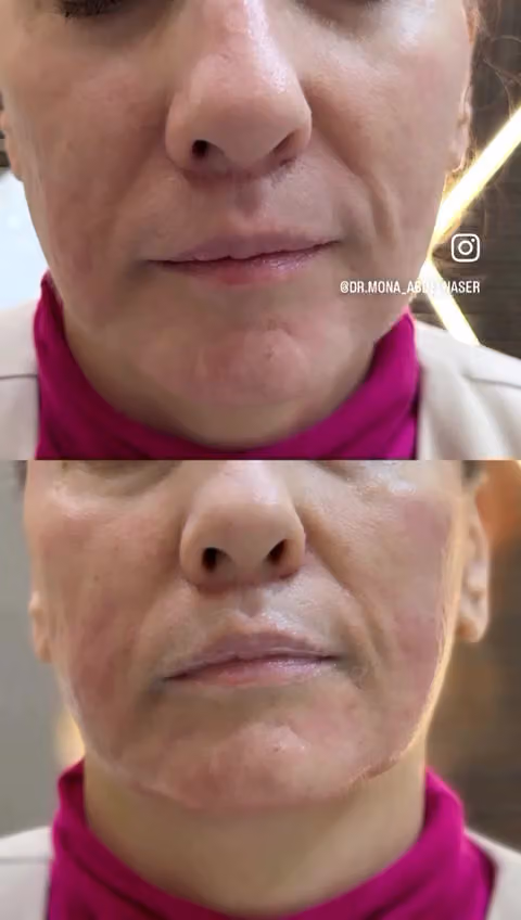 Dr. Mona abdalnaser clinic عيادة دكتوره منى عبد الناصر