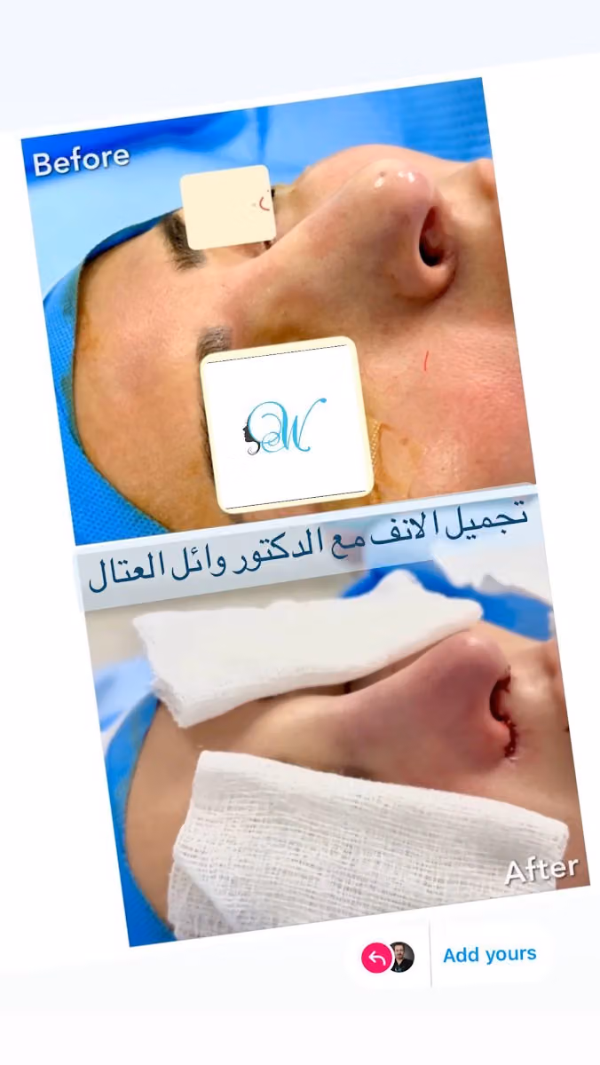Dr. Wael El-Attal Beauty Clinic عيادة الدكتور وائل العتال
