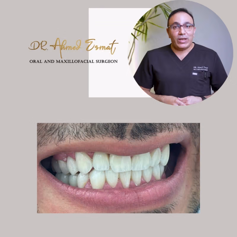 Dr.ahmed esmat د.احمد عصمت جراحه الوجه والفكين وزراعه الاسنان عيادات ريفريش