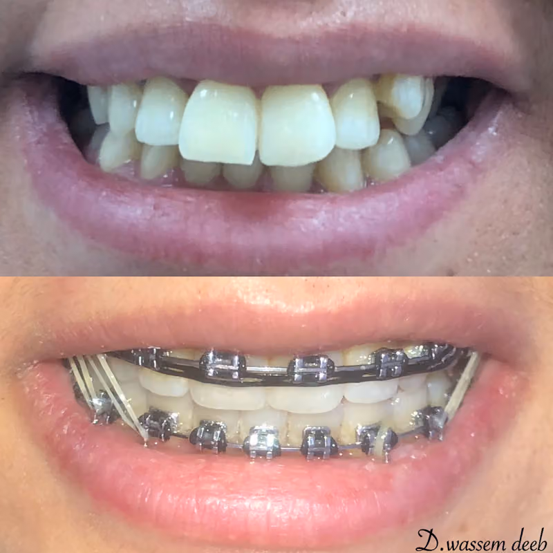 Dr.Wassem Deeb د. وسيم ديب Orthodontist