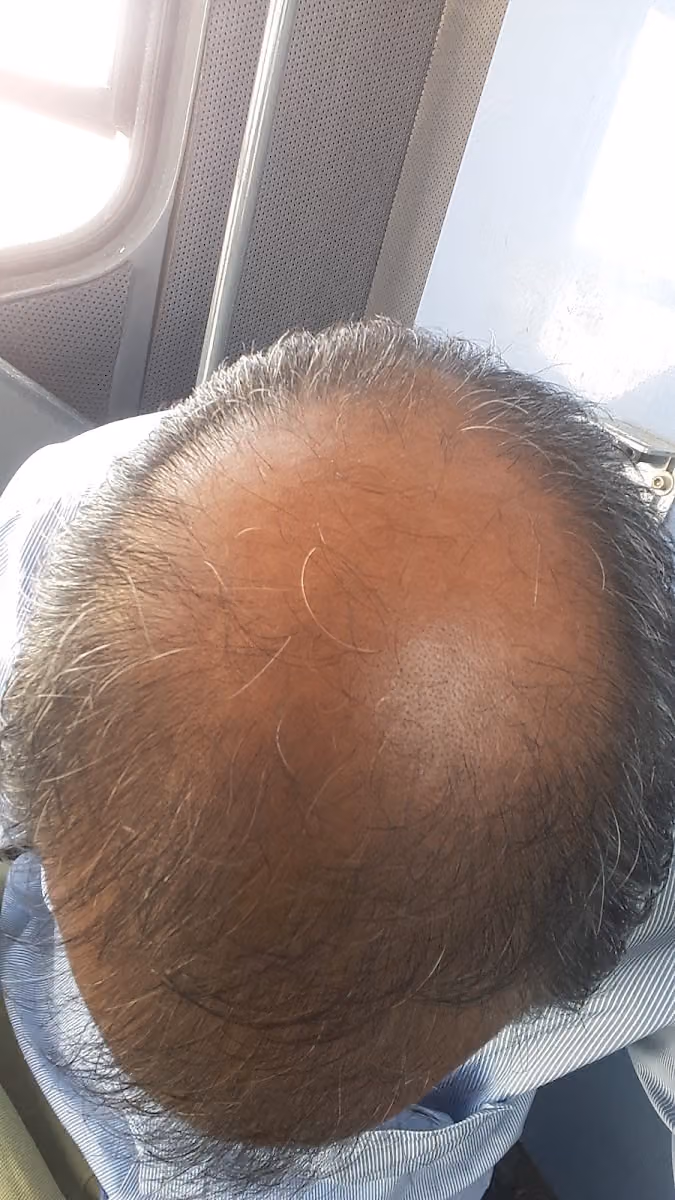 Gulfgate Hair Fixing Riyadh