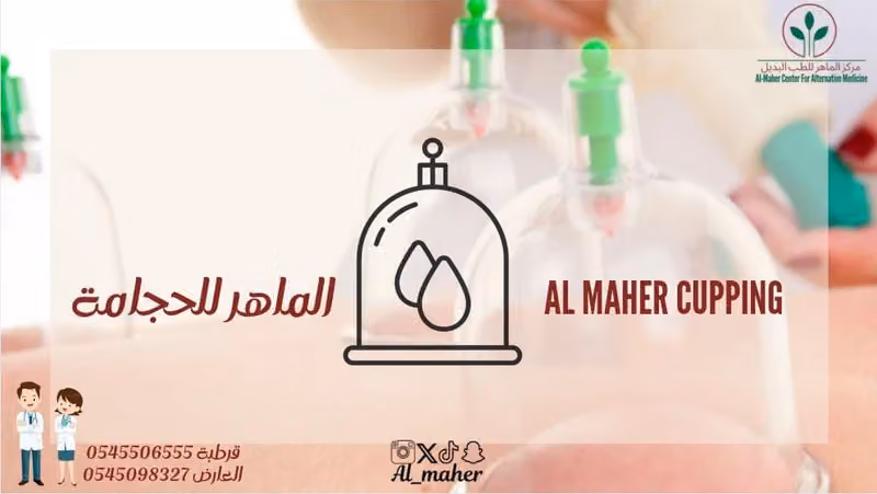 حجامة - الماهر للحجامة فرع العارض