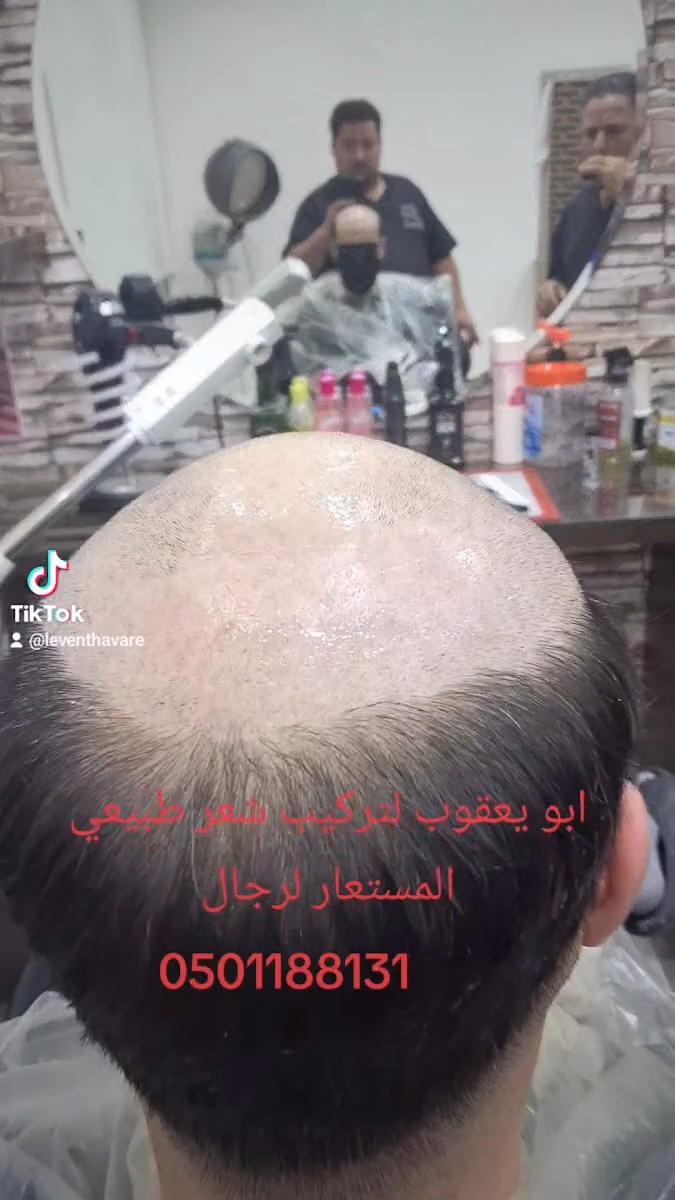 حلاق تركي تلاقي تركيب شعر طبيعي المستعار