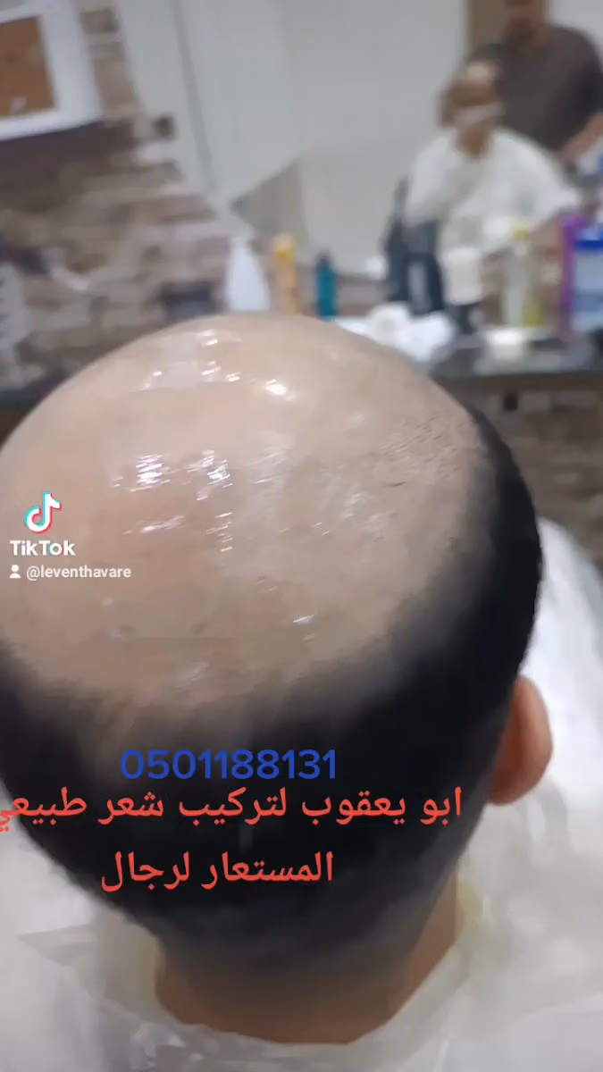 حلاق تركي تلاقي تركيب شعر طبيعي المستعار