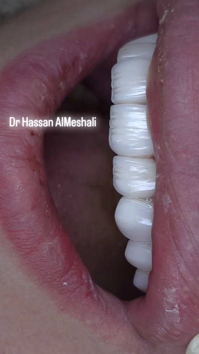 I Dent Clinics | آي دنت لطب وجراحة الفم والأسنان
