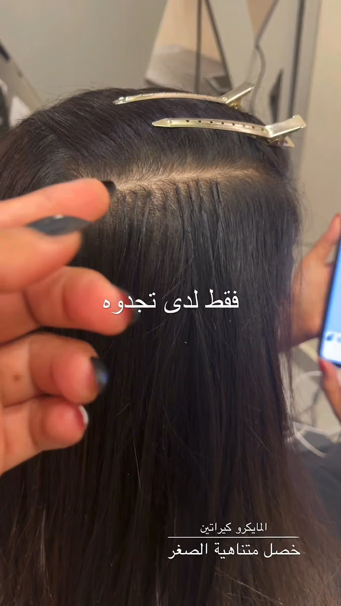 Luxury Hair مركز لاكجري هير