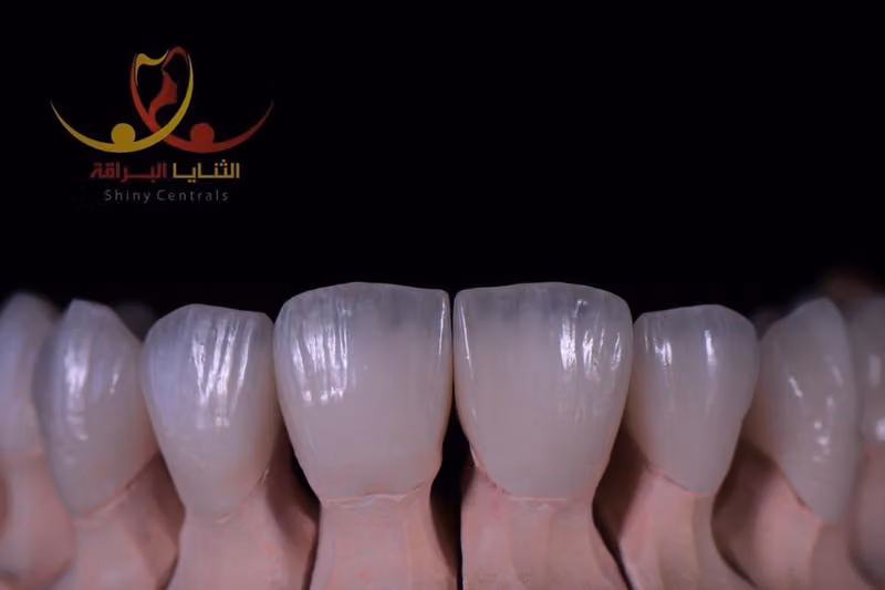 معمل الثنايا البراقة لصناعة الأسنان