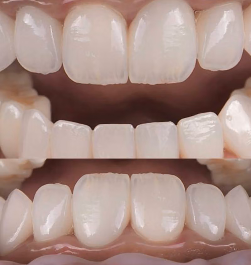 معمل ايفكت لتركيبات الأسنان Effect dental lab