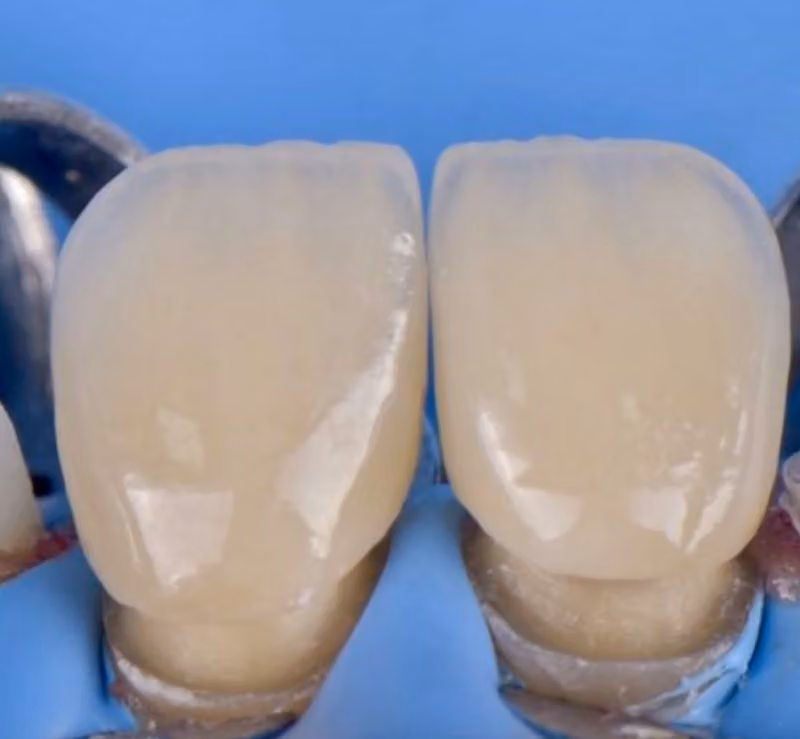 معمل ايفكت لتركيبات الأسنان Effect dental lab