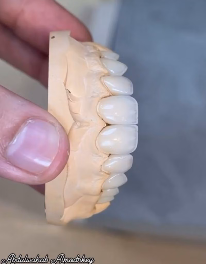 معمل ايفكت لتركيبات الأسنان Effect dental lab