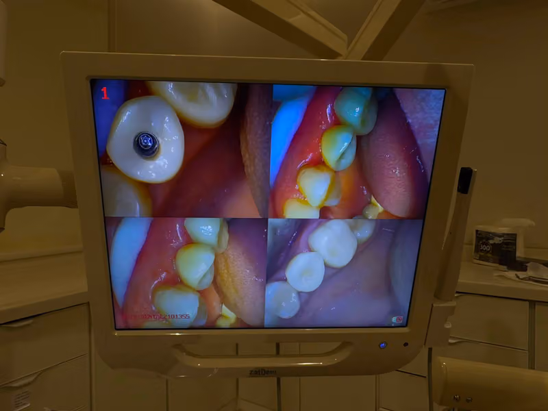 معمل ديجيتال سمايلز لتركيبات الاسنان Digital smiles dental lab