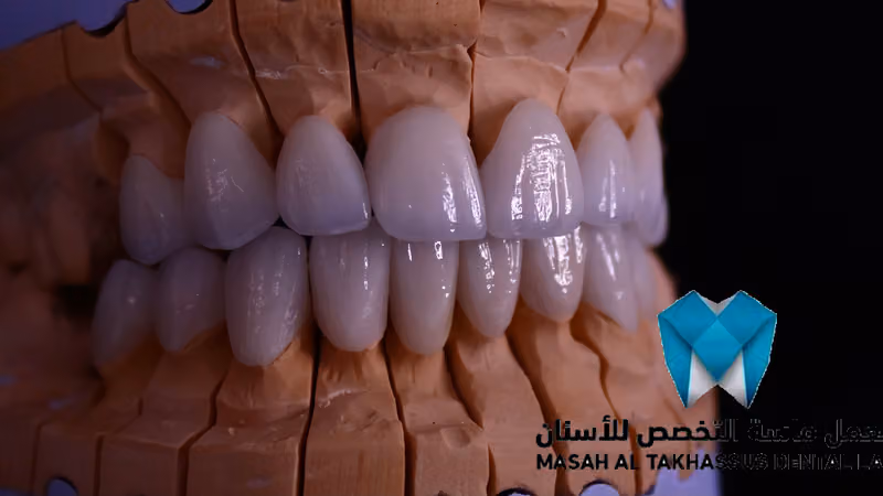 معمل ماسة التخصص للأسنان