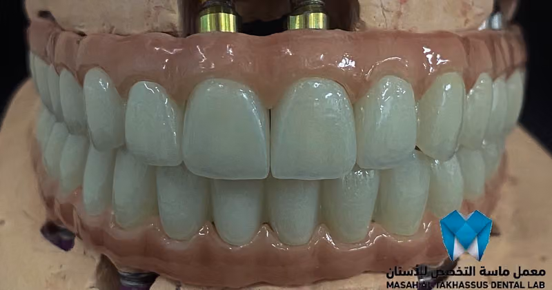 معمل ماسة التخصص للأسنان