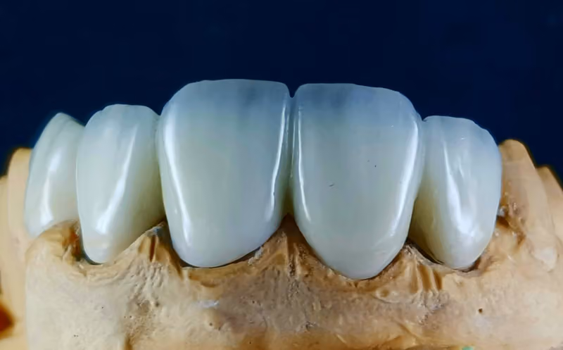 معمل نيرسن للأسنان | Nearsun For Dental