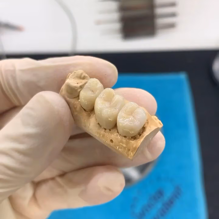 معمل رونق الابتسامه للأسنان