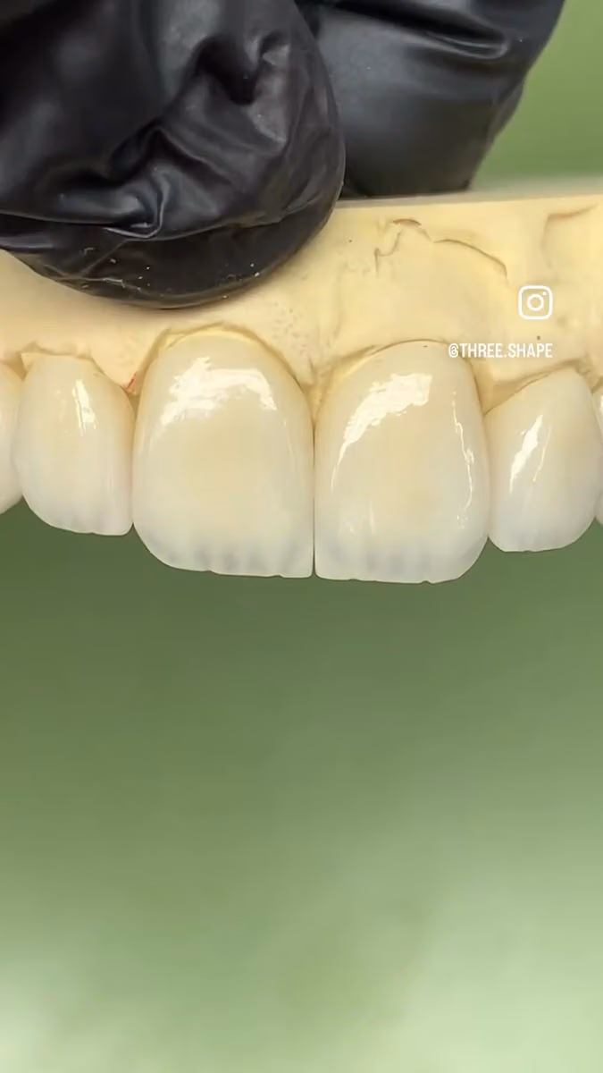 معمل ثري شيب للاسنان