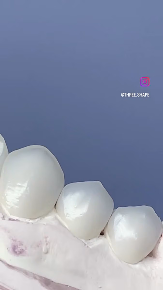 معمل ثري شيب للاسنان