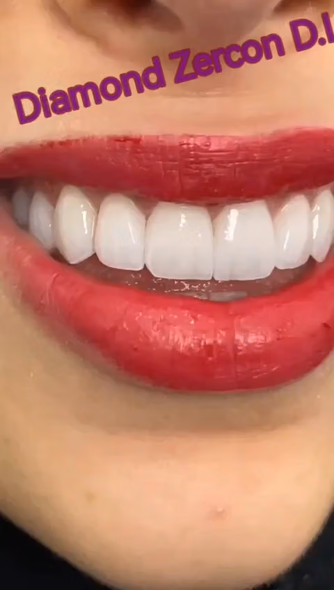 معمل زركون الماسي لتركيبات الاسنانDiamond Zercon Dental Lab