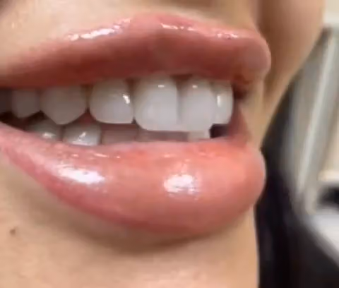 معمل زركون الماسي لتركيبات الاسنانDiamond Zercon Dental Lab