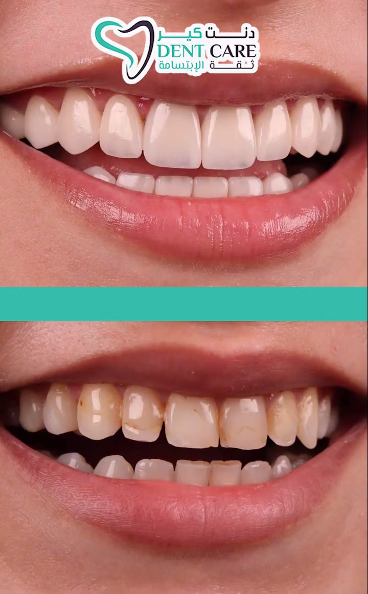مجمع عيادات دنت كير لطب الأسنان | Dent Care Clinic