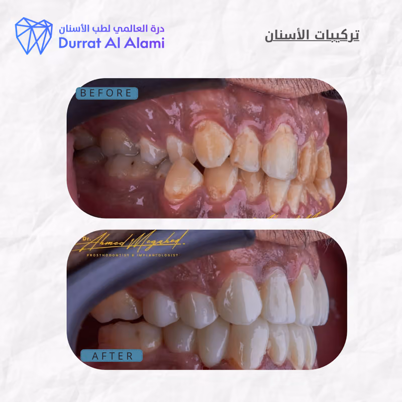 مجمع عيادات درة العالمي لطب الاسنان