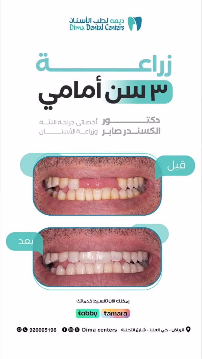 مجمع عيادات ديمة لطب الأسنان