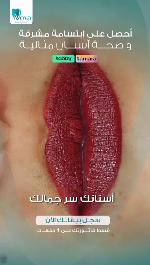 مجمع نوفا لطب الأسنان - الشفا
