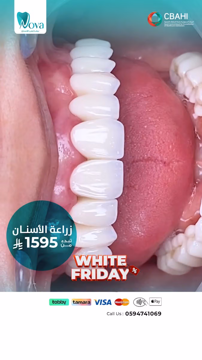 مجمع نوفا لطب الاسنان _ غرناطه