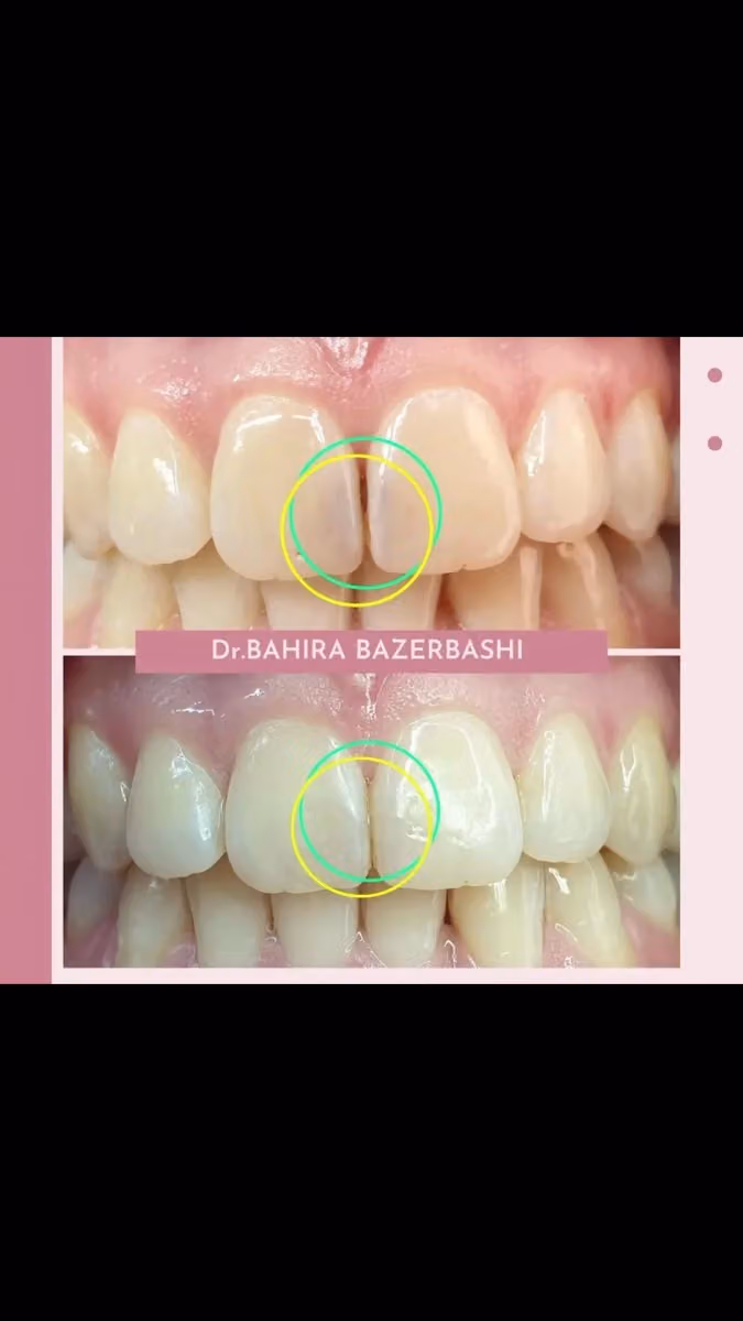 مجمع ركن الابتسامة لطب الأسنان