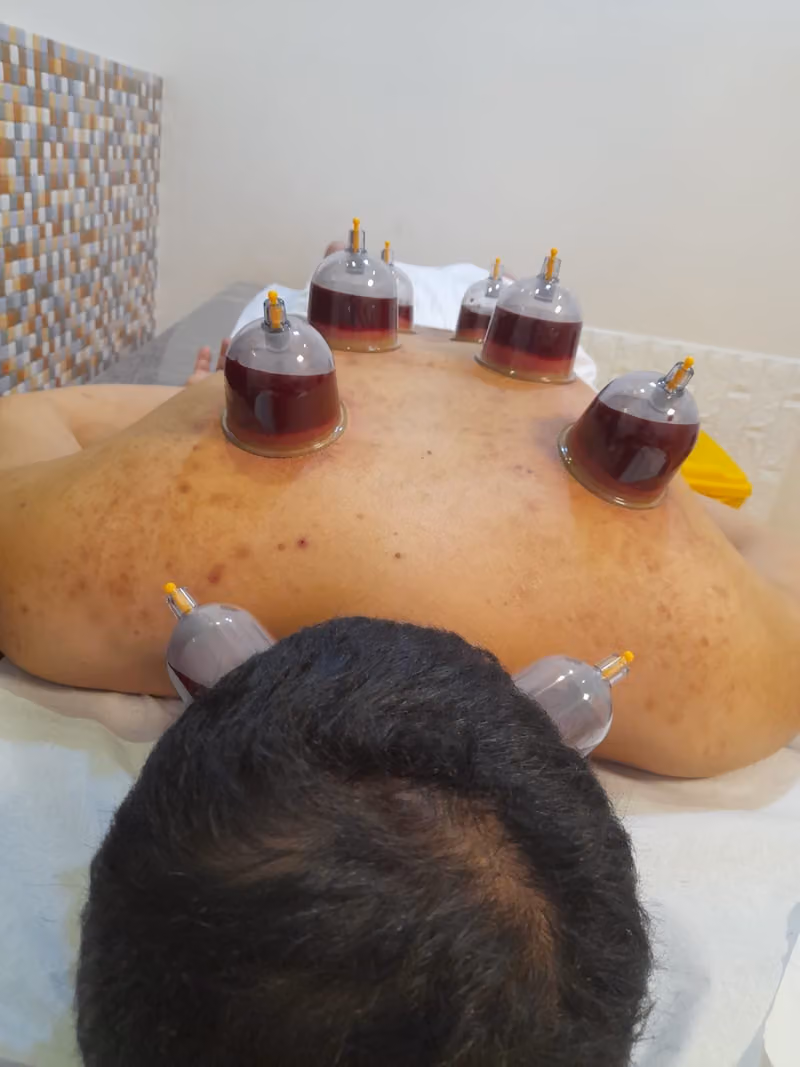 مركز أبوفيصل للحجامة المنزلية بالرياض
