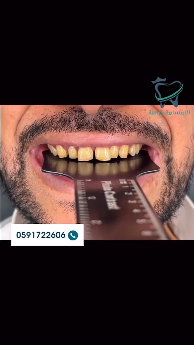 مركز الإبتسامة الرائعة لطب الأسنان