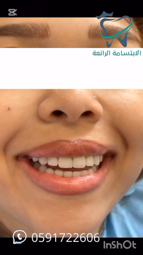 مركز الإبتسامة الرائعة لطب الأسنان