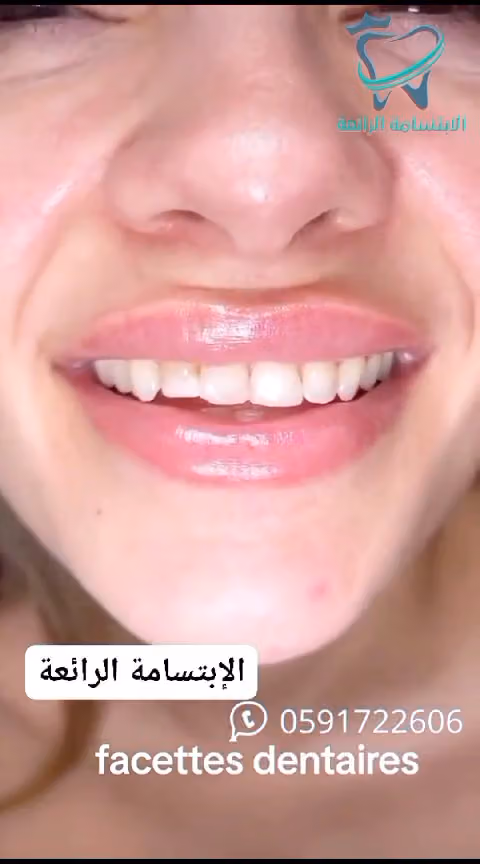 مركز الإبتسامة الرائعة لطب الأسنان
