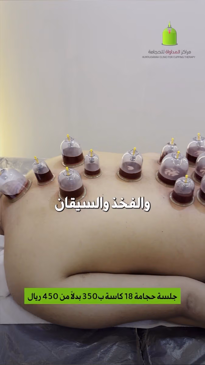 مركز المداواة للحجامه - فرع النسيم - الرياض
